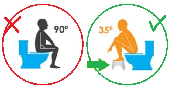 Правильное и неправильное положение при дефекации для ежедневного очищения кишечника